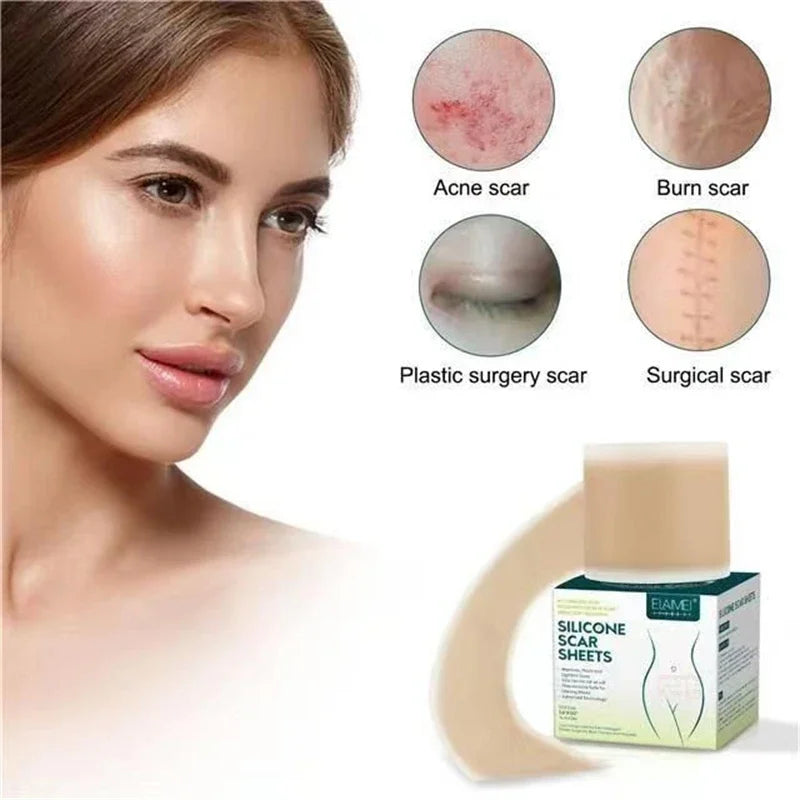Silicone Scar Sheets