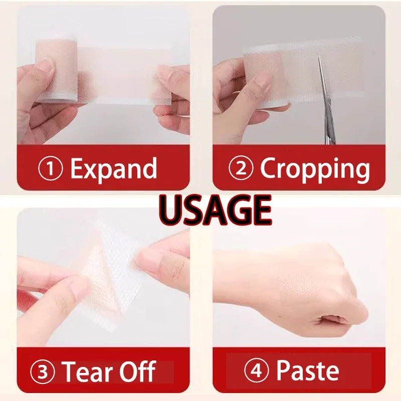 Silicone Scar Sheets