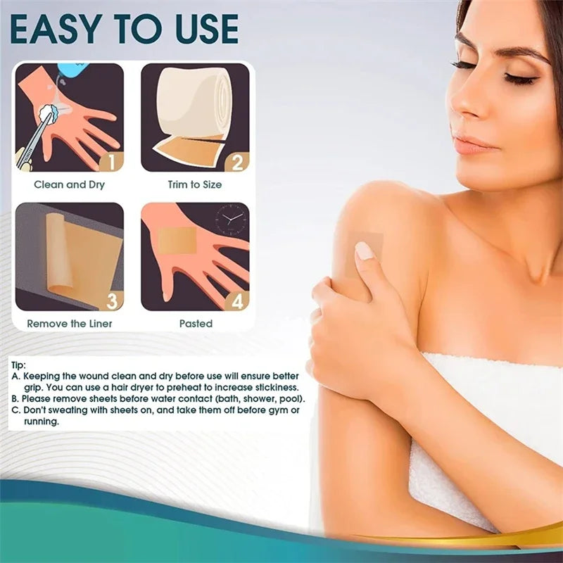 Silicone Scar Sheets