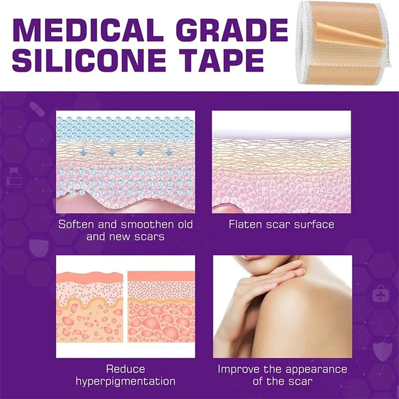 Silicone Scar Sheets
