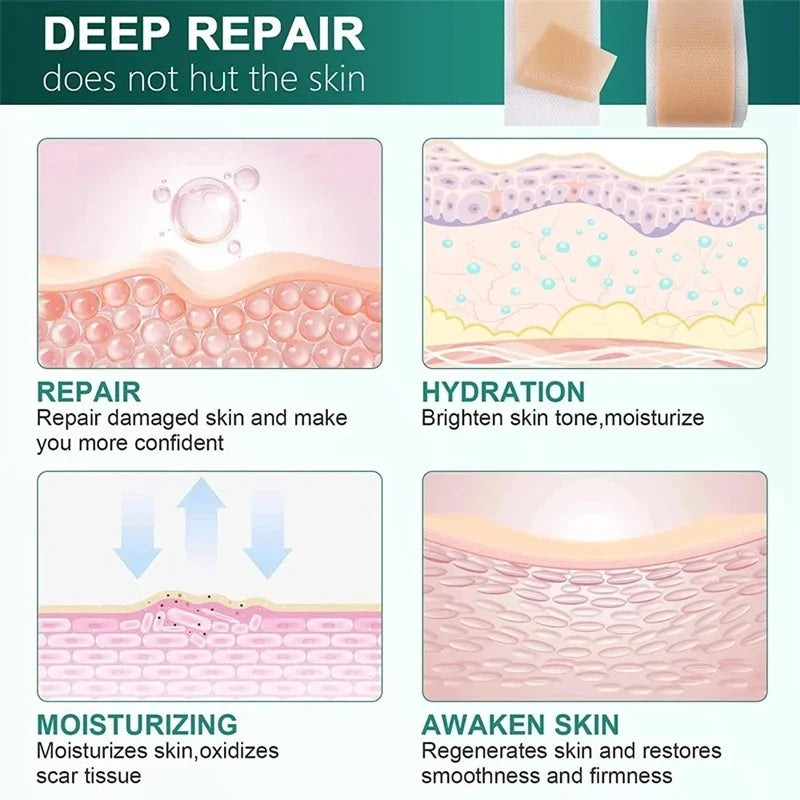 Silicone Scar Sheets