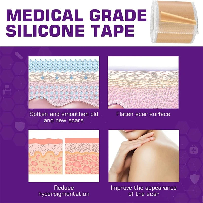 Silicone Scar Sheets