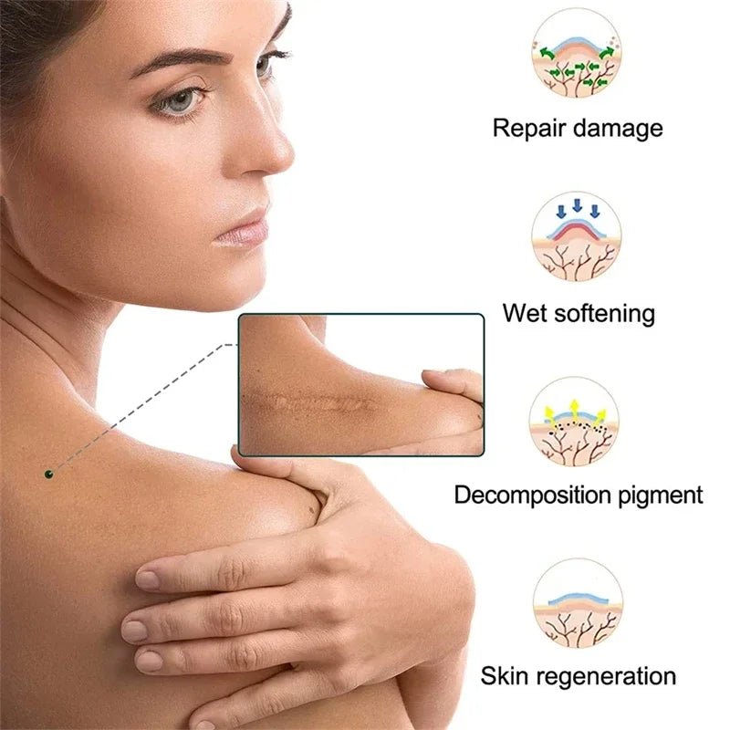 Silicone Scar Sheets