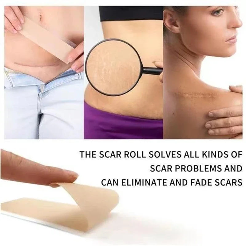 Silicone Scar Sheets