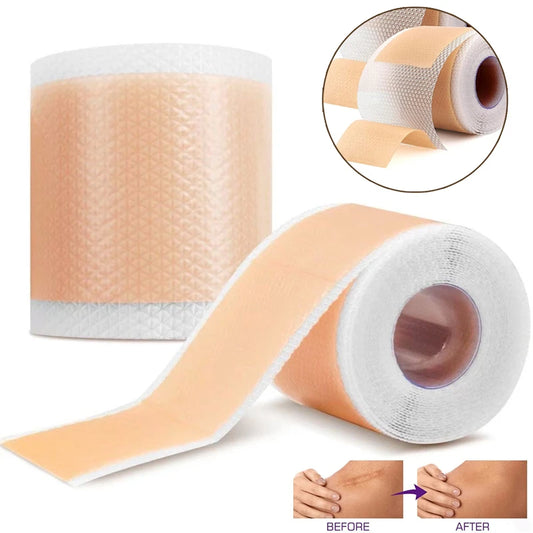 Silicone Scar Sheets