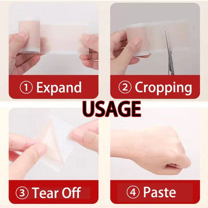 Silicone Scar Sheets