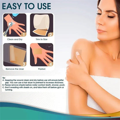 Silicone Scar Sheets