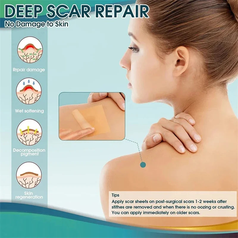 Silicone Scar Sheets