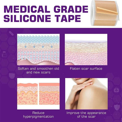Silicone Scar Sheets