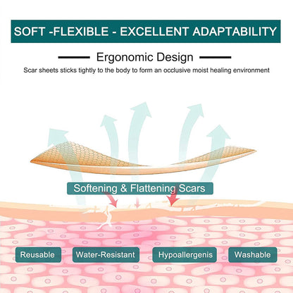 Silicone Scar Tape